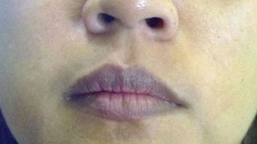 Mẹo nhận biết sức khỏe qua màu môi Meo nhan biet suc khoe qua mau moi