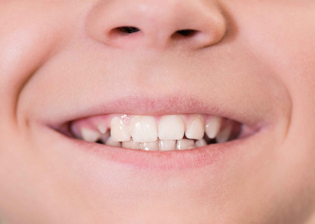 Mẹo nhận biết sức khỏe qua màu môi - Hình 2 Meo nhan biet suc khoe qua mau moi-Hinh-2