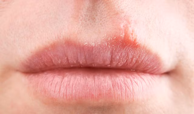 Meo nhan biet suc khoe qua mau moi-Hinh-3