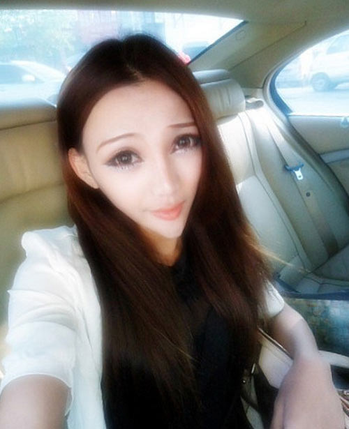 Những kiểu phẫu thuật thẩm mỹ có thể mất mạng đến bác sĩ cũng sợ - Hình 4 Nhung kieu phau thuat tham my co the mat mang den bac si cung so-Hinh-4