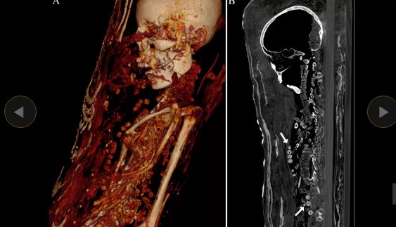 He lo bi mat ve 2 xac uop Ai Cap sau hon 400 nam-Hinh-3