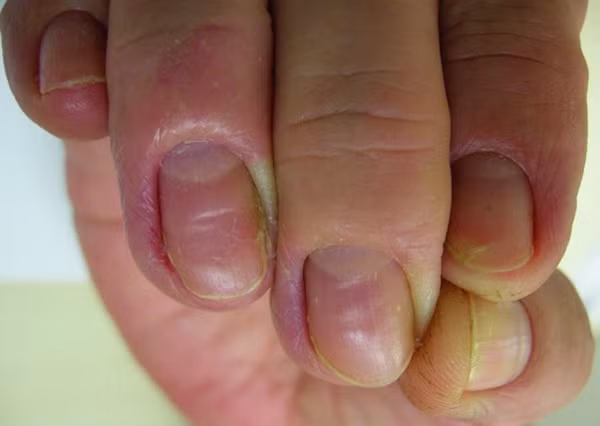 Nguoi dan ong tieu chay suyt chet vi bac si benh vien lon sai sot