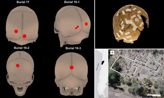 Hé lộ bí mật khủng khiếp của đế chế Inca qua những hộp sọ - Hình 2 He lo bi mat khung khiep cua de che Inca qua nhung hop so-Hinh-2