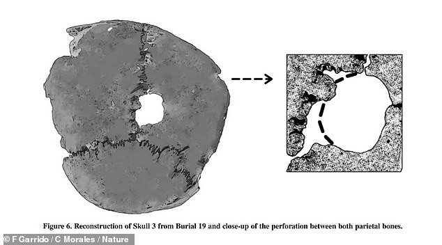 Hé lộ bí mật khủng khiếp của đế chế Inca qua những hộp sọ - Hình 7 He lo bi mat khung khiep cua de che Inca qua nhung hop so-Hinh-7