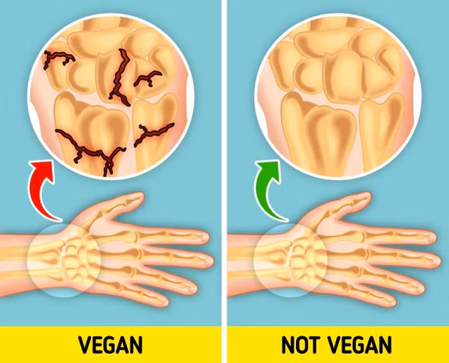 An chay truong se khien co the xay ra nhung dieu nay-Hinh-10