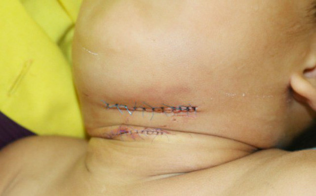 Cận cảnh những vụ trẻ em bị chó tấn công, thương tích cùng mình - Hình 7 Can canh nhung vu tre em bi cho tan cong, thuong tich cung minh-Hinh-7