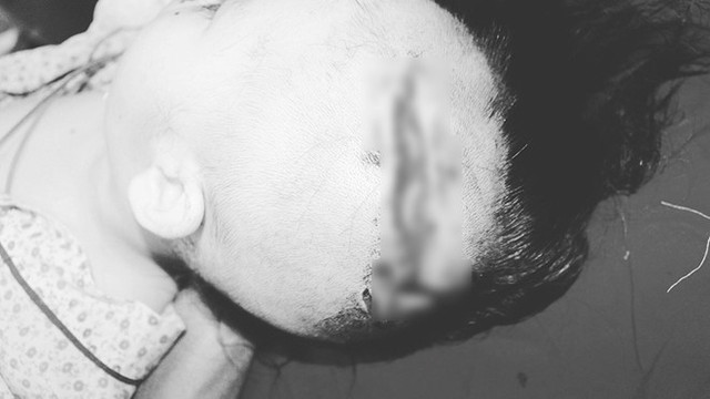 Cận cảnh những vụ trẻ em bị chó tấn công, thương tích cùng mình Can canh nhung vu tre em bi cho tan cong, thuong tich cung minh