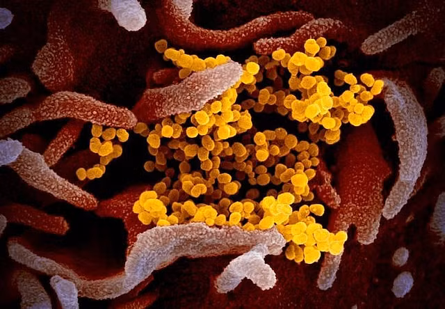 O nhiem khong khi khien nguoi nhiem Covid-19 benh nang hon