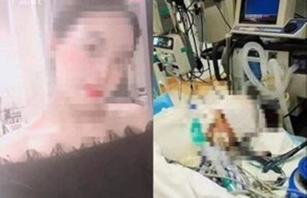 Cô gái tử vong sau phẫu thuật thẩm mỹ nâng mũi Co gai tu vong sau phau thuat tham my nang mui