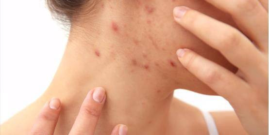 Khi cơ thể có 2 kiểu ngứa này, hãy đi khám ung thư ngay - Hình 2 Khi co the co 2 kieu ngua nay, hay di kham ung thu ngay-Hinh-2