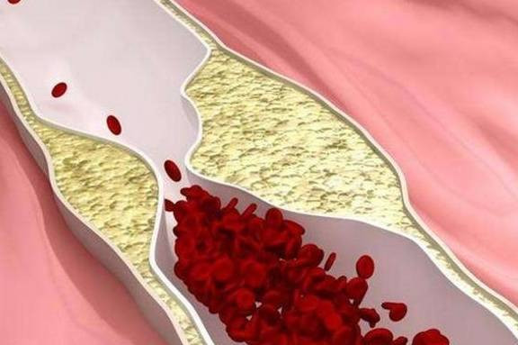 3 dấu hiệu xuất hiện sau khi ngủ dậy cần xét nghiệm máu ngay 3 dau hieu xuat hien sau khi ngu day can xet nghiem mau ngay