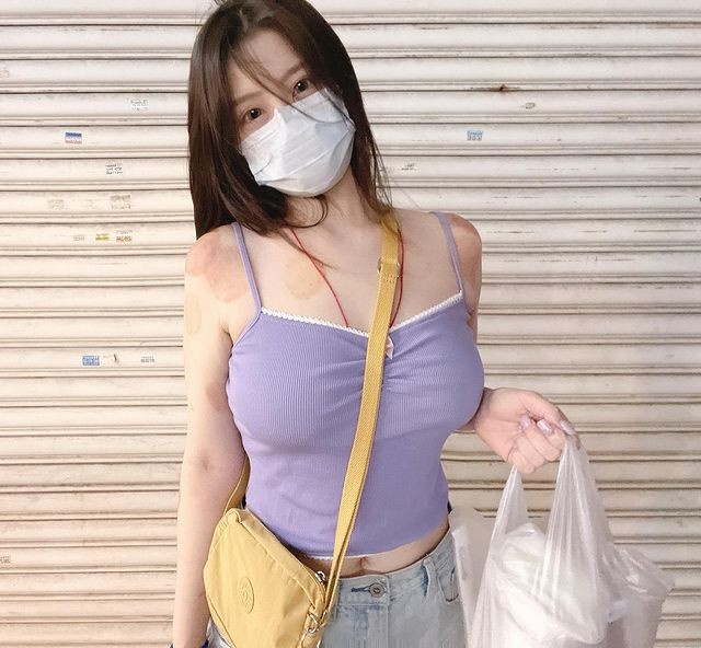 Hot girl mặc nội y khoe vết tiêm vắc xin COVID-19 gây bão mạng - Hình 2 Hot girl mac noi y khoe vet tiem vac xin COVID-19 gay bao mang-Hinh-2