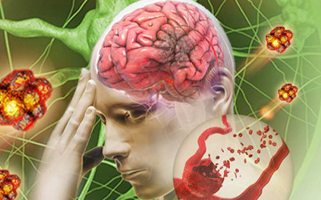 Hút thuốc lá có thể bị cụt chi - Hình 6 Hut thuoc la co the bi cut chi-Hinh-6