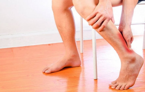Tắc nghẽn mạch máu mà tưởng bong gân Tac nghen mach mau ma tuong bong gan