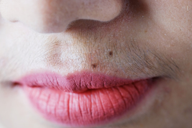 Phụ nữ mọc lông rậm cần chú ý các vấn đề sức khỏe này - Hình 2 Phu nu moc long ram can chu y cac van de suc khoe nay-Hinh-2