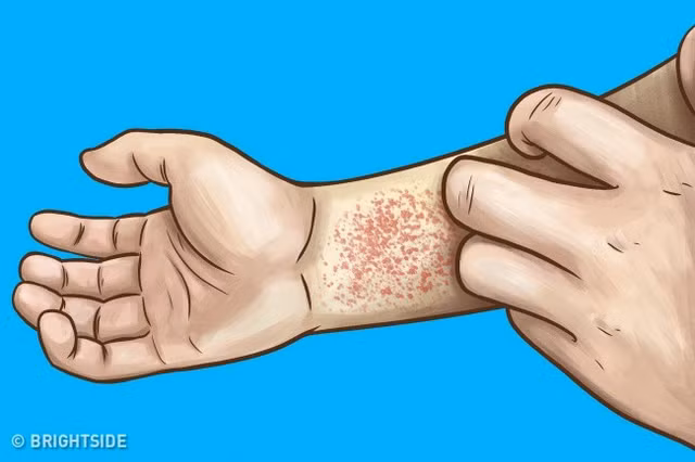 Canh bao 10 dau hieu suy than ban can chu y-Hinh-8