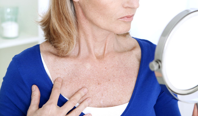 7 cách đơn giản xóa nếp nhăn vùng ngực hiệu quả 7 cach don gian xoa nep nhan vung nguc hieu qua