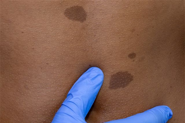 Nhìn làn da phát hiện những dấu hiệu nguy hiểm của cơ thể Nhin lan da phat hien nhung dau hieu nguy hiem cua co the