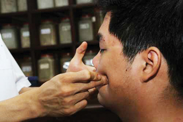 Lạm dụng điều hoà khiến người dùng bị liệt nửa mặt Lam dung dieu hoa khien nguoi dung bi liet nua mat