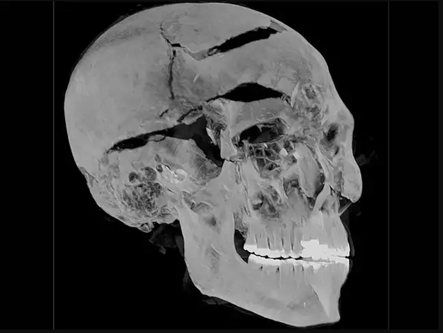 Phát hiện bất ngờ về cái chết của pharaoh Ai Cập - Hình 2 Phat hien bat ngo ve cai chet cua pharaoh Ai Cap-Hinh-2