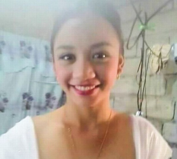 Kinh dị thiếu nữ 17 tuổi nguy cơ bị mù sau khi nặn mụn trên mũi Kinh di thieu nu 17 tuoi nguy co bi mu sau khi nan mun tren mui