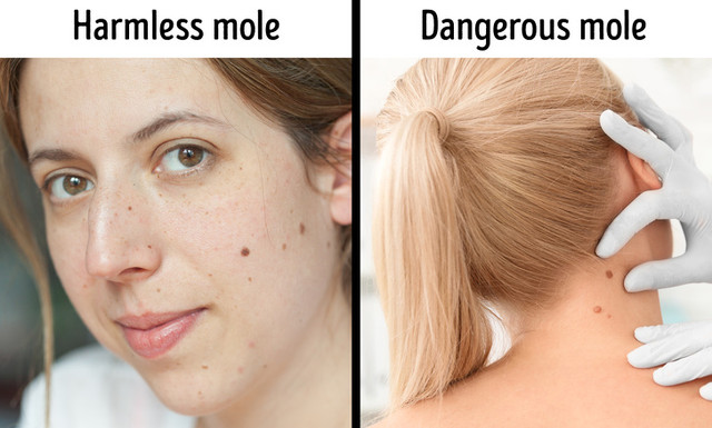 Hạn chế 10 thói quen làm đẹp này, kẻo hối hận khi về già - Hình 7 Han che 10 thoi quen lam dep nay, keo hoi han khi ve gia-Hinh-7