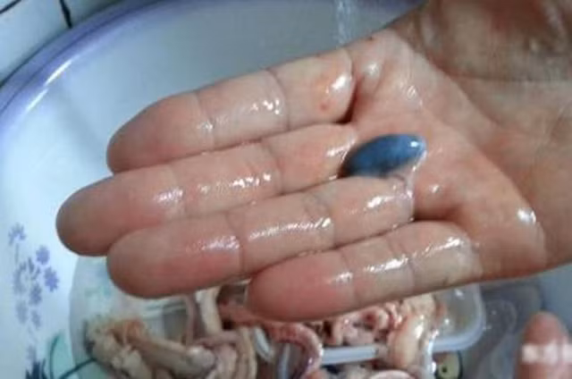 An ca nhat dinh phai bo bo phan nay neu khong muon mang benh-Hinh-6