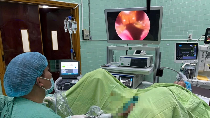 Bệnh viện Trung ương Huế triển khai Rezum điều trị tăng sinh tuyến tiền liệt