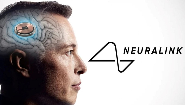 Neuralink, công ty cấy ghép giao diện não máy tính do Elon Musk sáng lập, vừa công bố robot có thể cấy chip vào não người chỉ trong 1,5 giây.