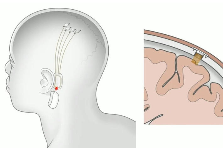 Các chuyên gia cảnh báo rủi ro lâu dài, vấn đề đạo đức và bảo mật dữ liệu thần kinh.