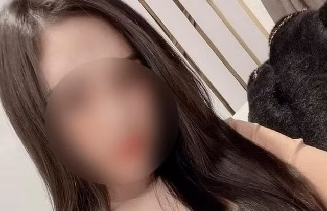 Cô gái sinh năm 2000 tử vong sau phẫu thuật nâng mũi ở Hà Nội Co gai sinh nam 2000 tu vong sau phau thuat nang mui o Ha Noi