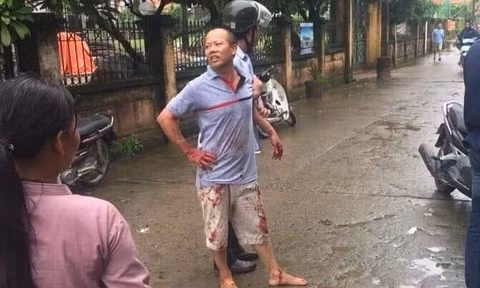 Hiện trường vụ anh trai giết 4 người trong gia đình em ruột rồi vào nhà uống trà - Hình 6 Hien truong vu anh trai giet 4 nguoi trong gia dinh em ruot roi vao nha uong tra-Hinh-6