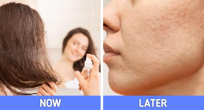 5. Dùng nhiều sản phẩm liên quan đến tóc: Một số sản phẩm giúp tóc bóng khỏe, đồng thời có thể gây mụn trên khuôn mặt của bạn. Dầu gội, dầu xả và các sản phẩm tạo kiểu tóc sẽ làm mụn cám mọc theo chân tóc của bạn (đặc biệt là vùng trán). Nếu những sản phẩm này dính vào mặt, chúng có thể làm tắc lỗ chân lông và gây kích ứng da.