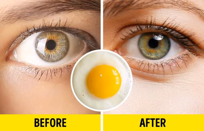 Trứng rất giàu protein. Tóc và lông mi được cấu tạo từ keratin. Thực phẩm giàu protein sẽ cung cấp đủ lượng axit amin cần thiết để sản xuất keratin, nhờ đó, kích thích lông mi mọc dài hơn.