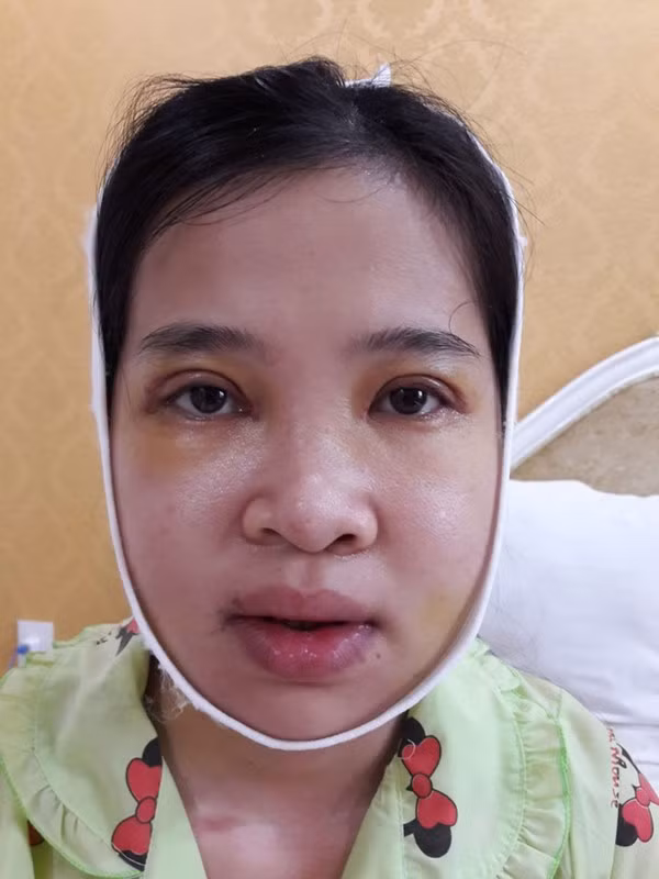Không dám yêu ai vì cằm bồ nông, cô gái Sài Gòn "lột xác" - Hình 2 Khong dam yeu ai vi cam bo nong, co gai Sai Gon
