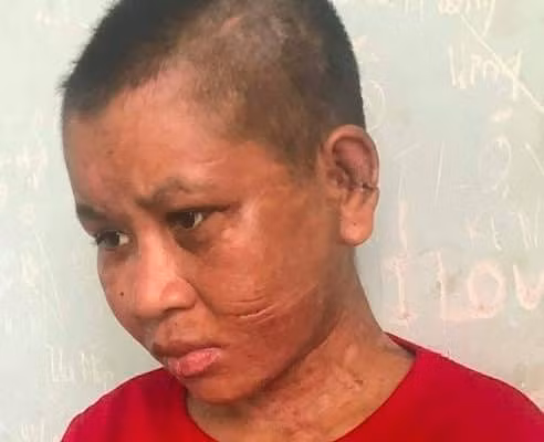 Hai hung nguoi phu nu bi tra tan toi bien dang o Gia Lai