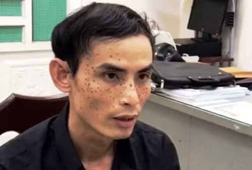 Tiết lộ gây "sốc" nạn nhân vụ cướp ô tô trên QL1A Tiet lo gay