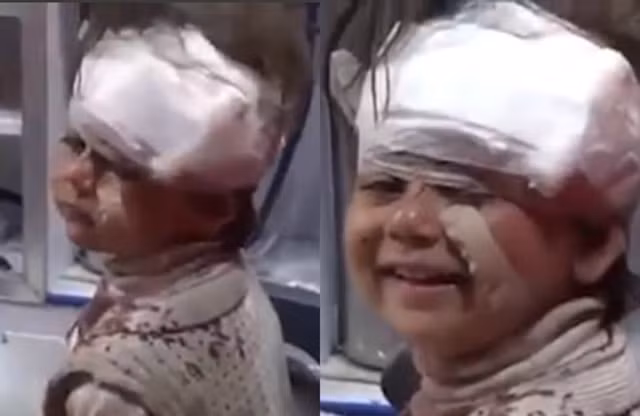 Bé Syria mặt rớm máu vẫn mỉm cười khiến dân mạng bật khóc Be Syria mat rom mau van mim cuoi khien dan mang bat khoc