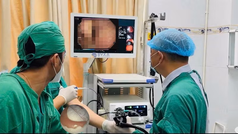 Người đàn ông 51 tuổi nuốt nhầm hàm răng giả vì sơ ý