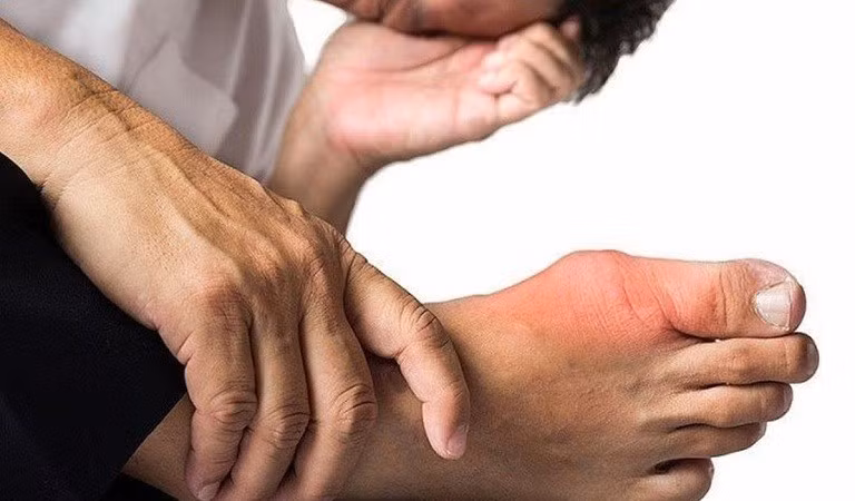 Những sai lầm phổ biến khiến bệnh gút tiến triển nhanh hơn