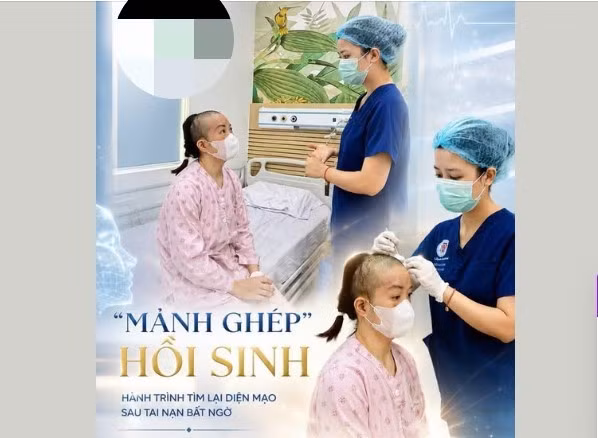 ghep-so-6500.jpg