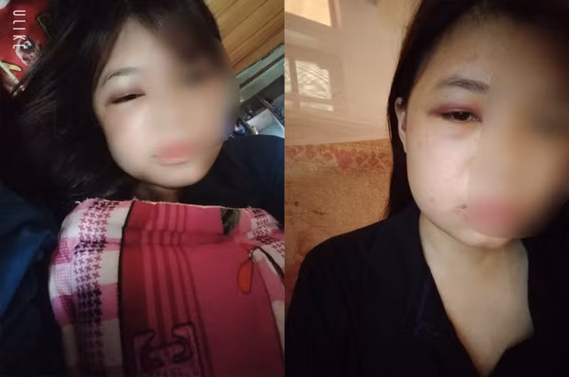(Đã edit) Điều tra nhóm nữ sinh lớp 10 liên tiếp đánh bạn rồi tung lên mạng xã hội ở Quảng Bình (Da edit) Dieu tra nhom nu sinh lop 10 lien tiep danh ban roi tung len mang xa hoi o Quang Binh