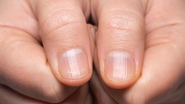 Bàn tay xuất hiện những dấu hiệu này cảnh báo bệnh hiểm Ban tay xuat hien nhung dau hieu nay canh bao benh hiem