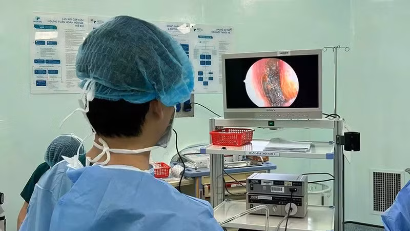 Gắp thành công pin cúc áo nằm sâu trong mũi bé trai 4 tuổi