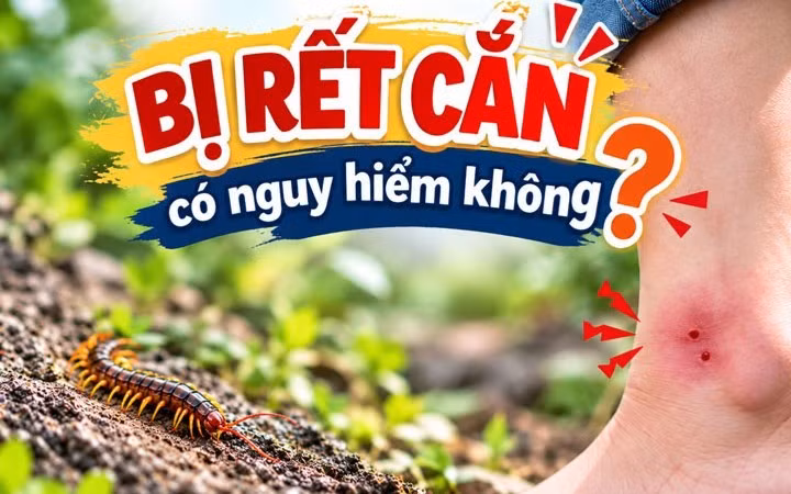 Bác sĩ hướng dẫn sơ cứu khi bị rết cắn để hạn chế nguy hiểm