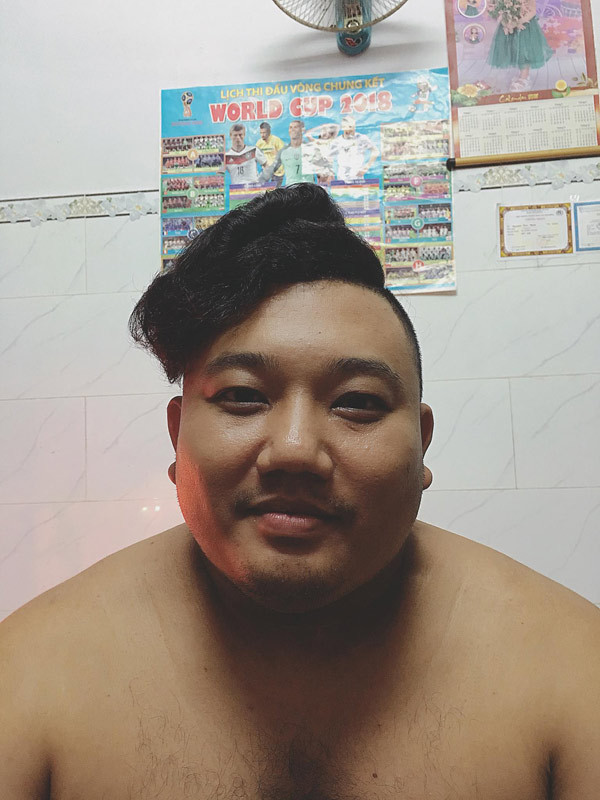 Kiểu tóc gây cười nữa là undercut nhưng phiên bản lỗi cũng khiến người nhìn thấy hài hước, đáng yêu.