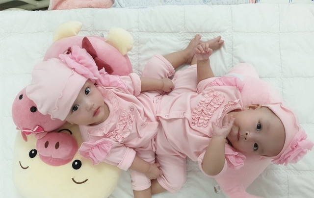 Gần 100 chuyên gia mổ tách song sinh dính nhau Gan 100 chuyen gia mo tach song sinh dinh nhau