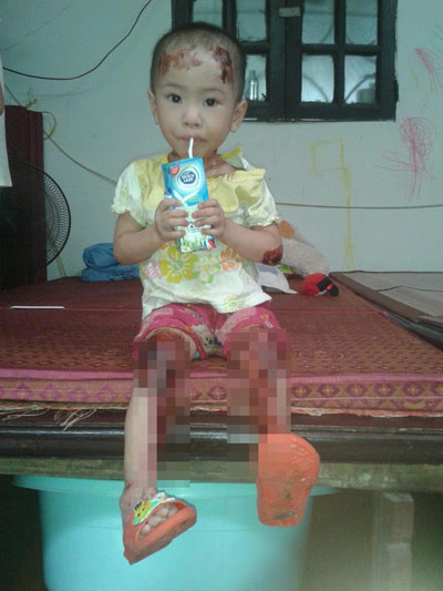 Bé Tâm Anh. Bé Tâm Anh.