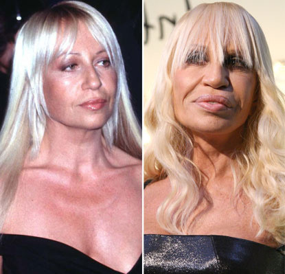 Hình ảnh nhà thiết kế danh tiếng Donatella Versace với khuôn mặt góc cạnh, cá tính năm 1997 đã thay bằng hình ảnh một phụ nữ có khuôn mặt méo mó vì lạm dụng thẩm mỹ.