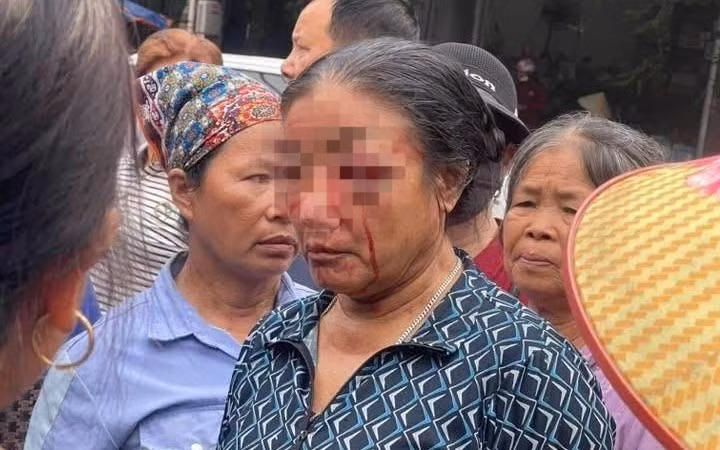 Xác minh vụ người bán rau bị xịt nước gây chảy máu mặt